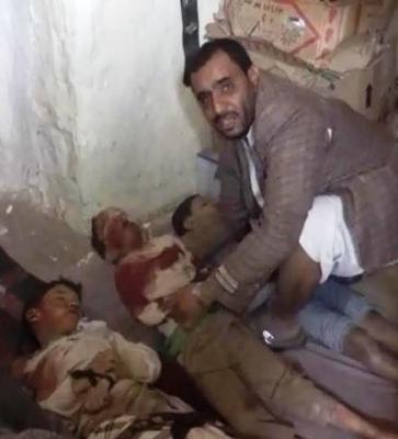 Almotamar Net - The death toll from the Saudi aggression coalition airstrikes on a hotel and popular market in Saada province rose to 29 civilians on Wednesday. 

The Saudi coalition committed a massacre on Souk Al-Layl market and nearby hotel in Sahar district by launching airstrikes, in which the death toll rose 